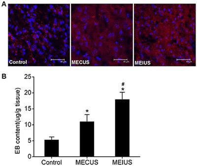 Increasing of Blood-Brain Tumor Barrier Permeability through Transcellular and Paracellular Pathways by Microbubble-Enhanced Diagnostic Ultrasound in a C6 Glioma Model